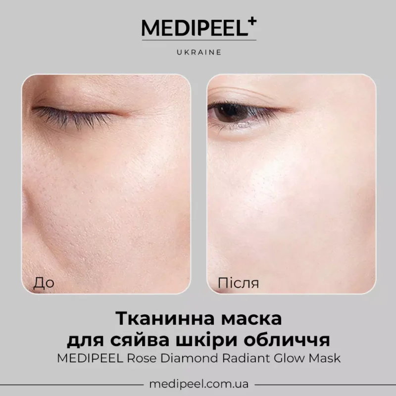Тканинна маска Medi Medi-Peel Rose Diamond Radiant Glow Mask з алмазною пудрою, 25 мл